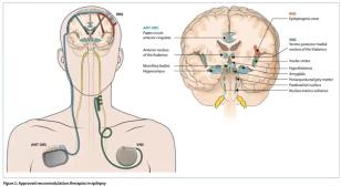 Brain and neck diagram