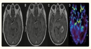 MRI Scans