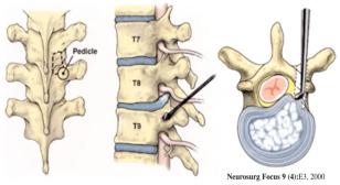 Spine diagram