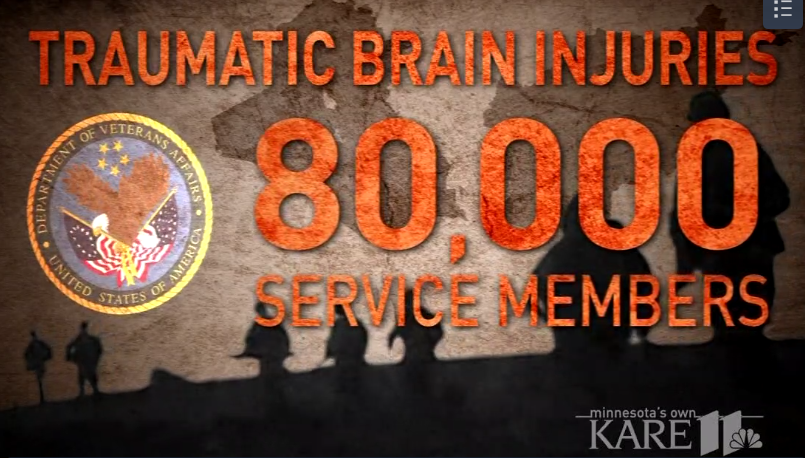 TBI's effect over 80,000 in the armed forces