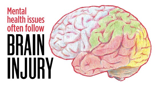 Brain injury graphic 