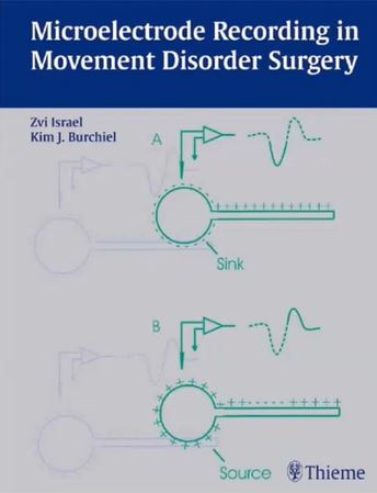 intraoperative microrecording diagram