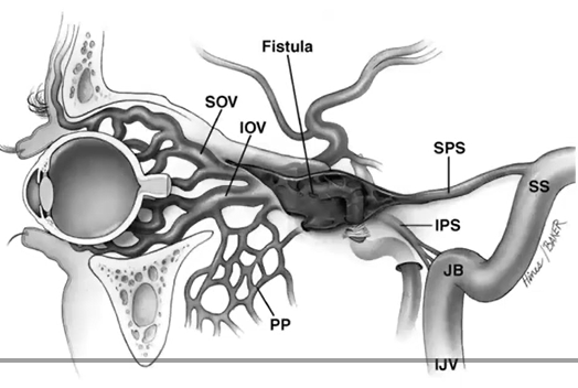 Diagram of the eye and nerves behind it