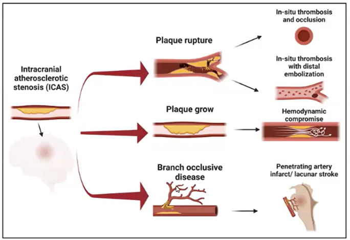 Diagram of cerebrovascular concepts