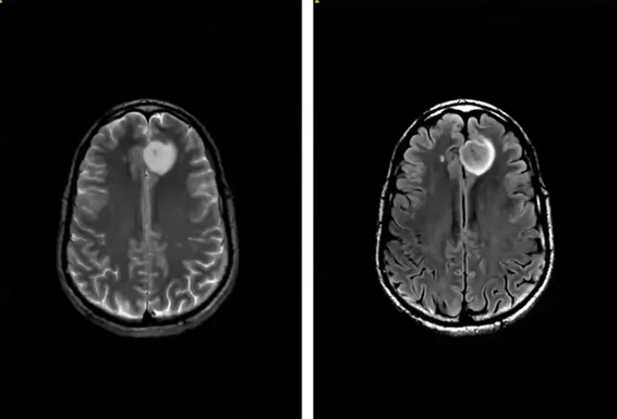 Image of brain scanas