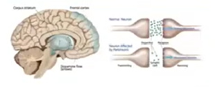 Diagram of a human brain and synapses