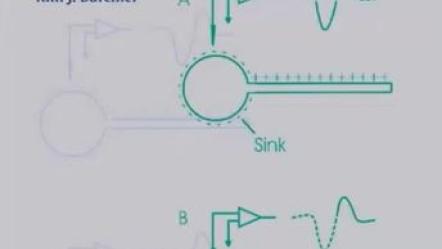 intraoperative microrecording diagram