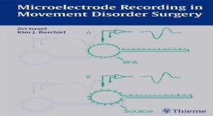 intraoperative microrecording diagram