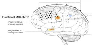 Sub-I Presentations – UW Medicine Neurological Surgery Grand Rounds: 7/23/2025 Brain model with labels