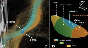 Sub-I Presentations – UW Medicine Neurological Surgery Grand Rounds: 9/10/2025 Diagram