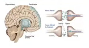 Diagram of a human brain and synapses