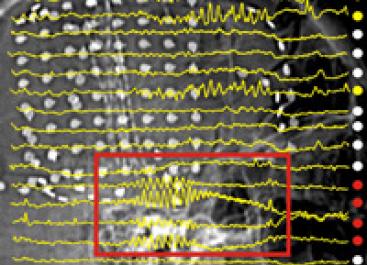 brain wave patterns