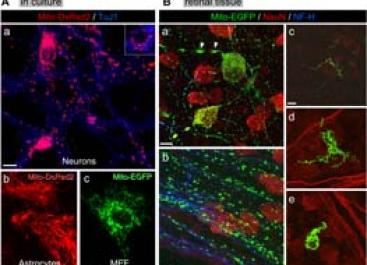 retinal tissue culture images