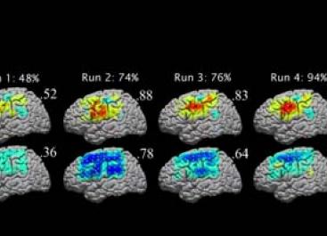 Image of brain scans